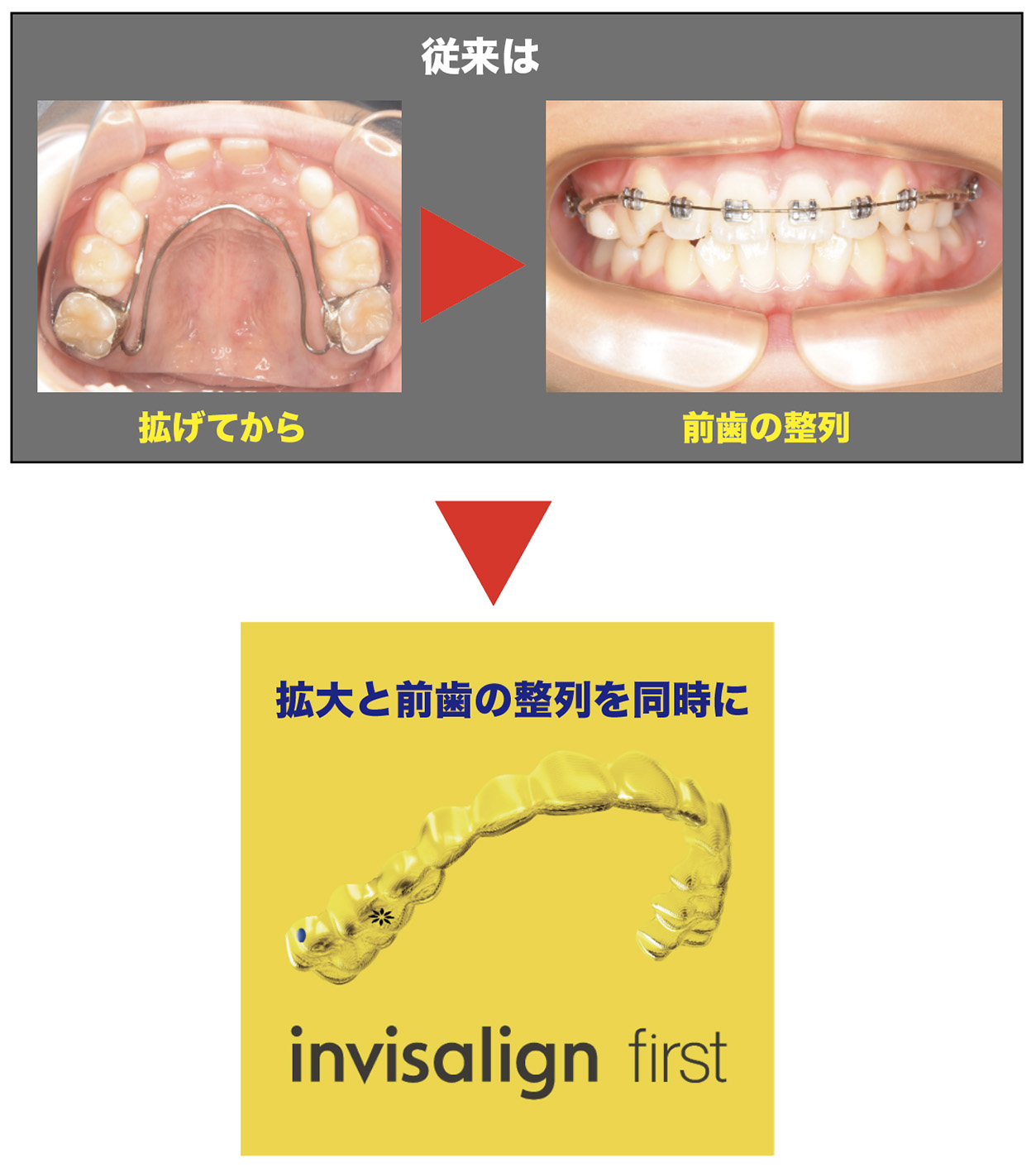 従来との比較