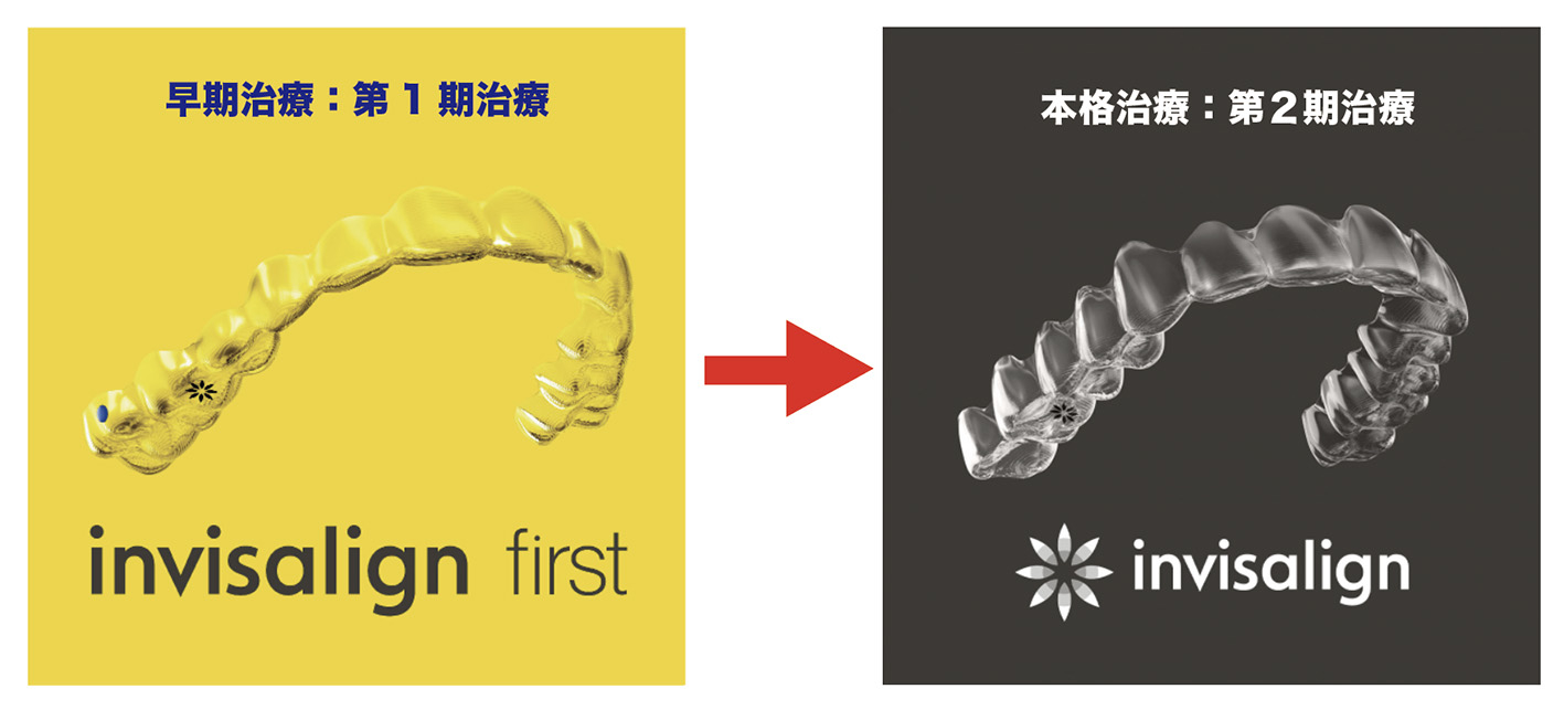 本格矯正