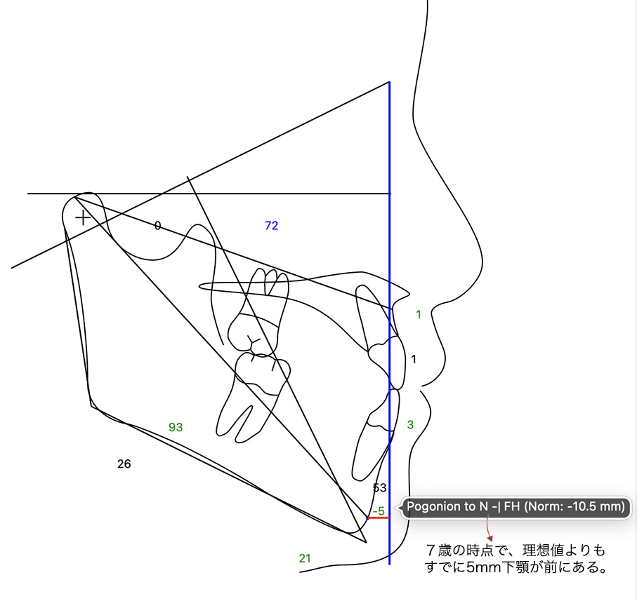 seityouyosoku1